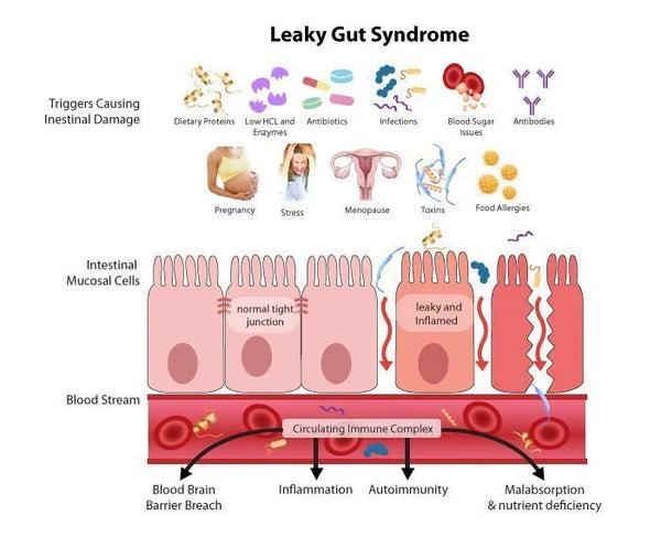Why is everyone talking about Leaky Gut?